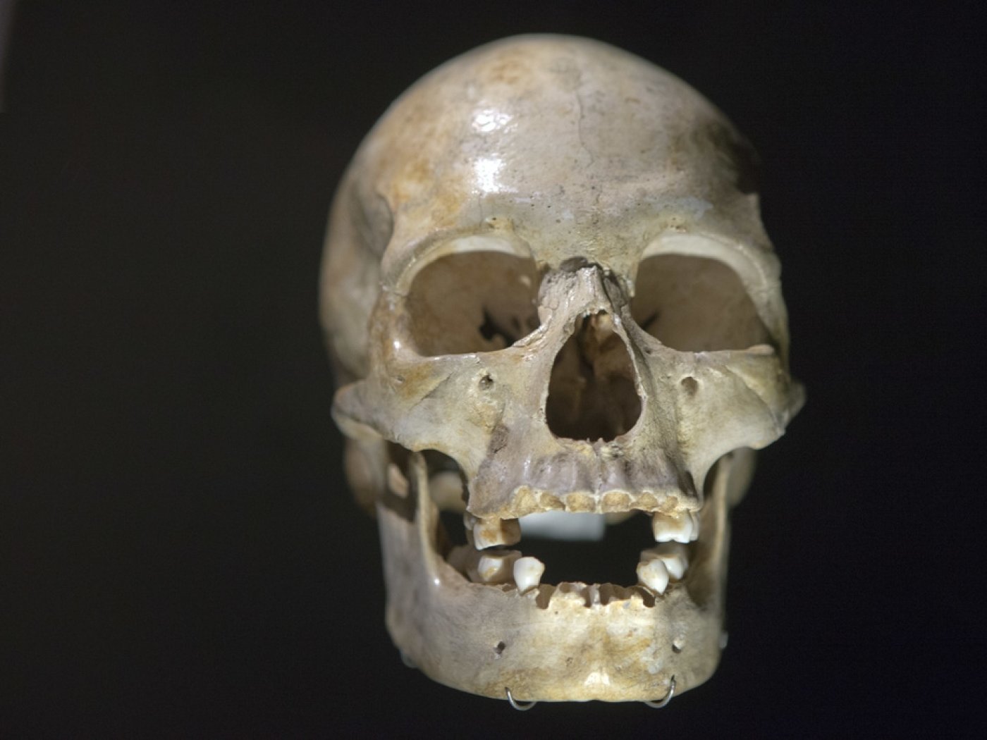 Les ossements du corps et les fragments du crâne présentaient une morphologie étonnamment moderne, faisant d’Omo 1 le plus ancien fossile d’Homo sapiens (illustration).