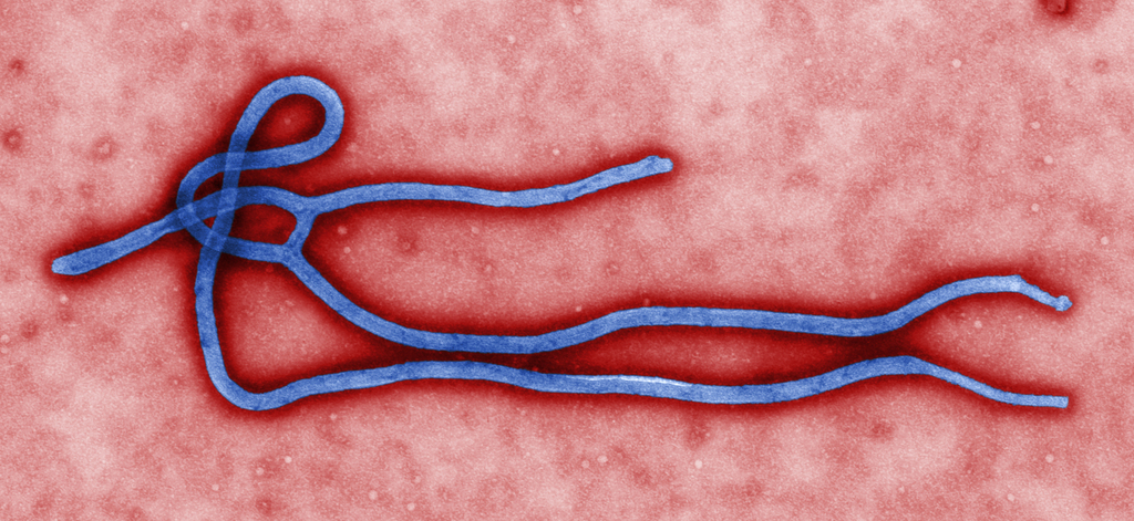 Le virus Ebola qui sévit actuellement en République démocratique du Congo (RDC) a une source différente de celle qui a provoqué l'épidémie faisant rage en Afrique de l'Ouest, selon une étude parue mercredi.