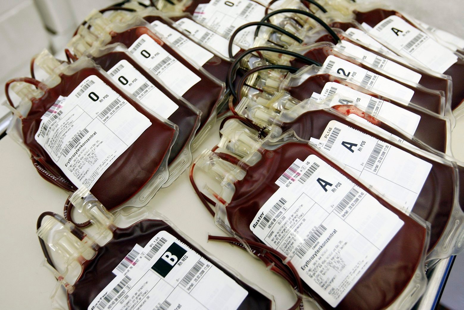 ZUM BLUTSPENDE-STREIT ZWISCHEN DEM ROTEN KREUZ UND BLUTSPENDE ZUERICH STELLEN WIR IHNEN AM FREITAG, 11. DEZEMBER 2009 FOLGENDES ARCHIVBILD ZUR VERFUEGUNG - Beutel mit frisch gespendetem Blut liegen am 11. Januar 2008 auf einem Tisch beim Blutspendedienst des Schweizerischen Roten Kreuzes SRK in Zuerich. (KEYSTONE/Alessandro Della Bella)



 SCHWEIZ BLUT BLUTSPENDE ZUERICH