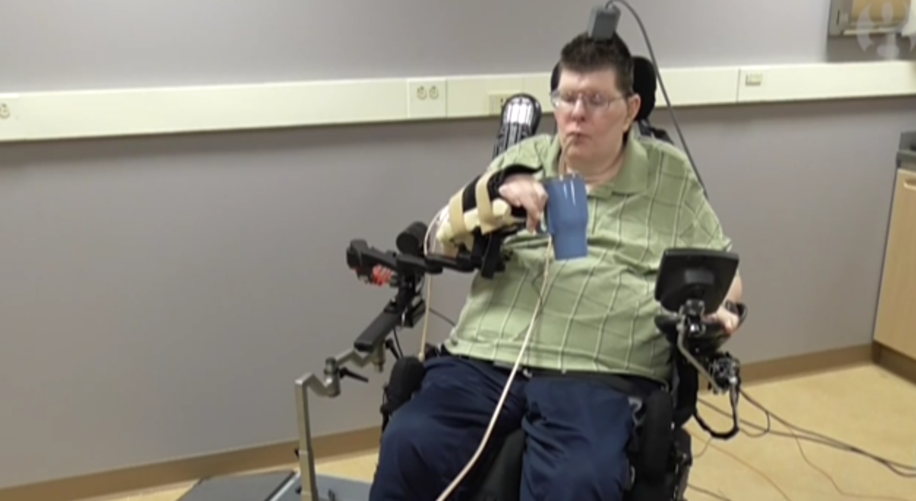 Pour bouger sa main et son bras par la pensée, le tétraplégique de 56 ans a deux boîtiers sur la tête et 192 micro-électrodes implantées dans le cerveau. 
