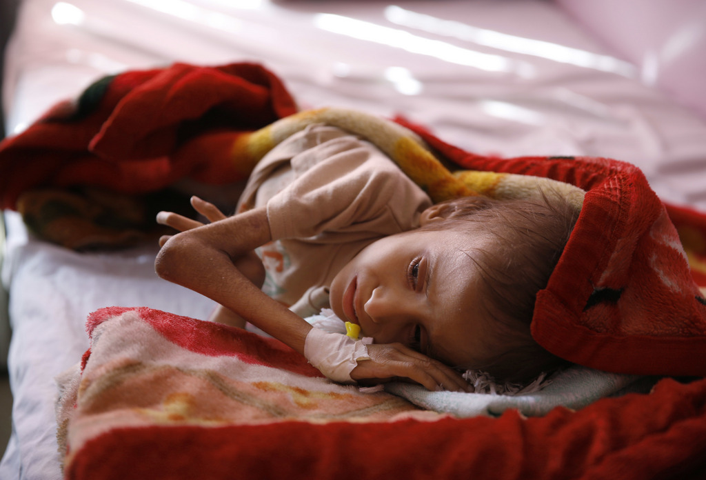 Un demi-million d'enfants souffrent de malnutrition.