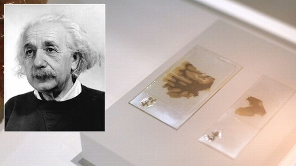 Les lamelles du cerveau d'Einstein seront visibles sur une application iPad.