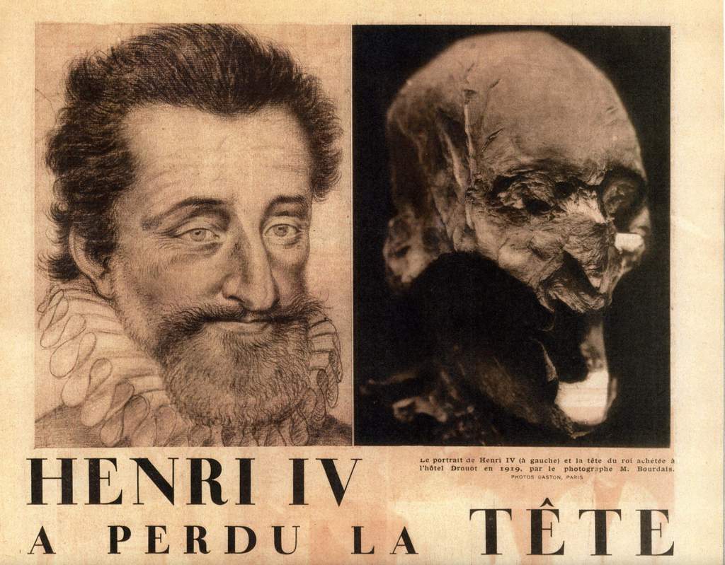 Retrouvé en 2008, le crâne d'Henri IV a été authentifié en 2010.
