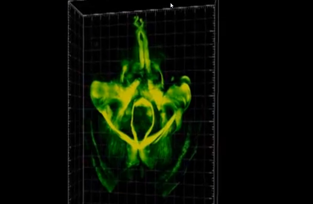 Des chercheurs sont parvenus à rendre le cerveau d'une souris morte totalement transparent pour voir ce qui s'y passe. Cette prouesse leur a tout de même permis d'étudier, en trois dimensions et sans dissection, l'intégralité de ses neurones et structures moléculaires.